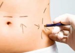 cirurgia-plastica-sao-caetano-do-sul-1354732728